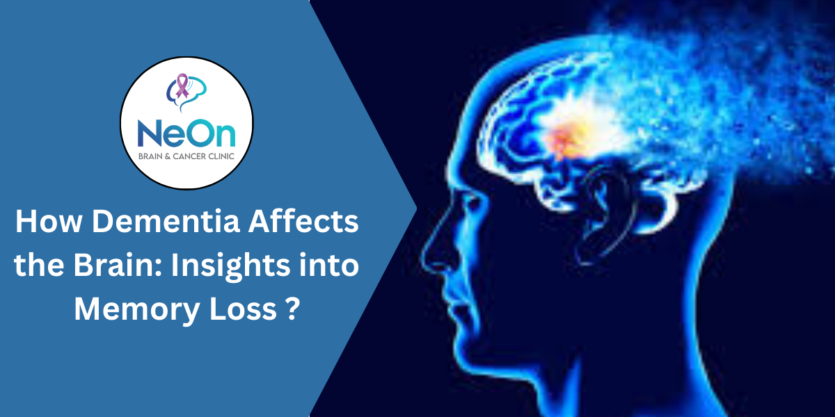 How Dementia Affects the Brain: Insights into Memory Loss ?