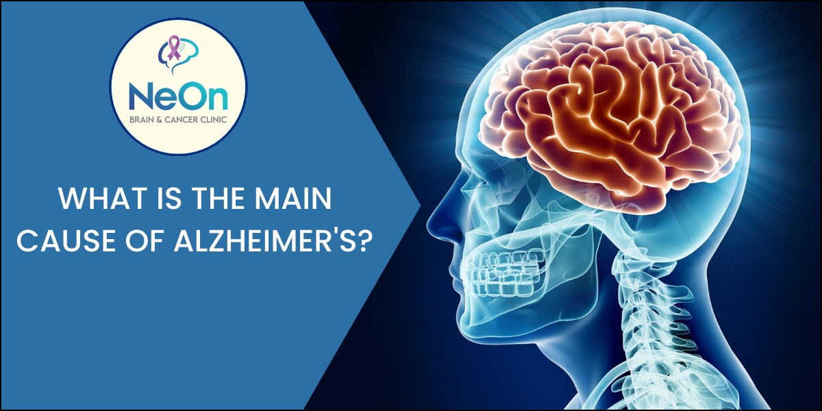 What is the main cause of Alzheimer’s?